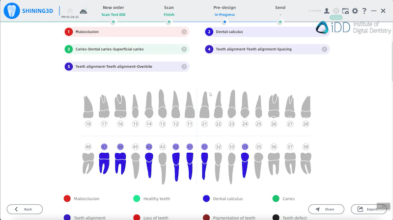 ConsulReport shining3D elite iDD
