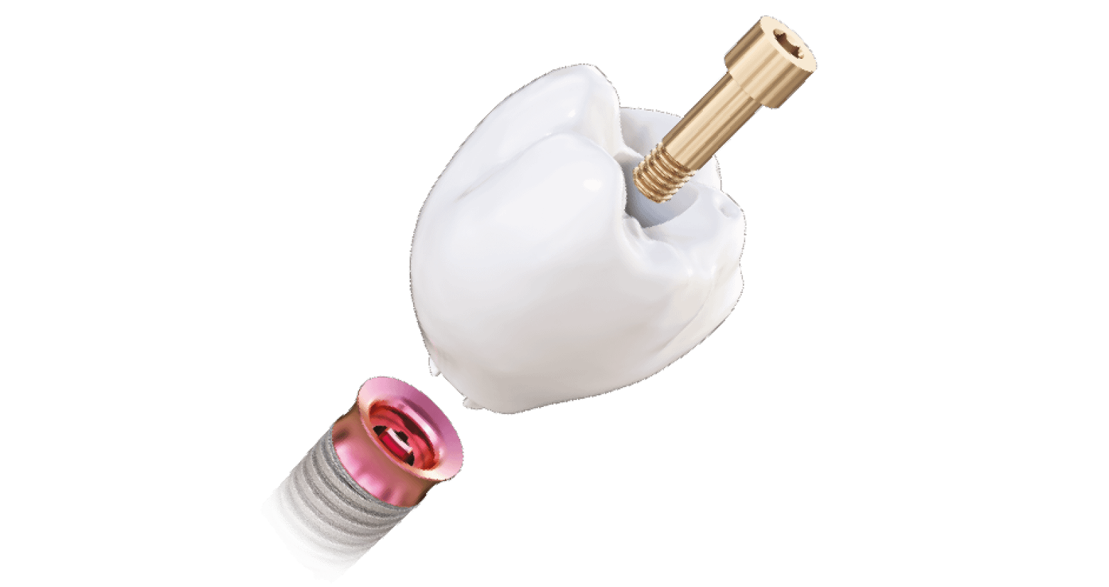 DDD-Podcast-S2E6-tri-dental-matrix-line-implants-idd-institute-of-digital-dentistry