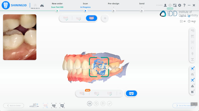 dynamic bite shining 3d elite