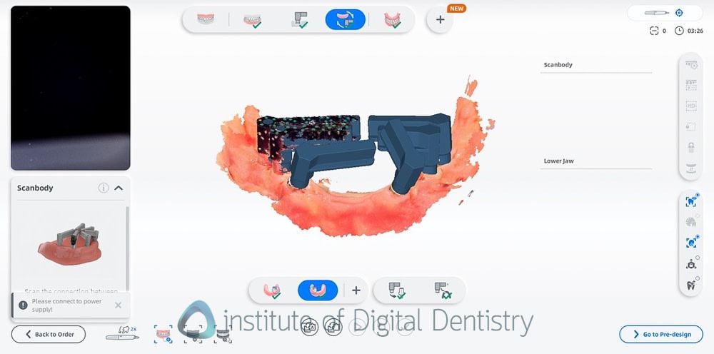 shining_3D_aoralscan_elite_review_institute_of_digital_dentistry11