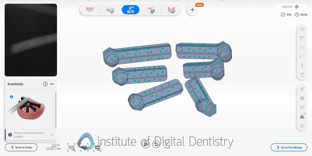 shining_3D_aoralscan_elite_review_institute_of_digital_dentistry2