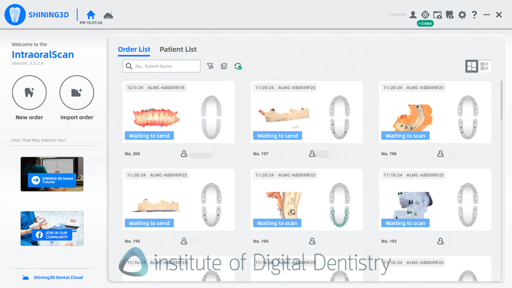 shining_3D_aoralscan_elite_review_institute_of_digital_dentistry49