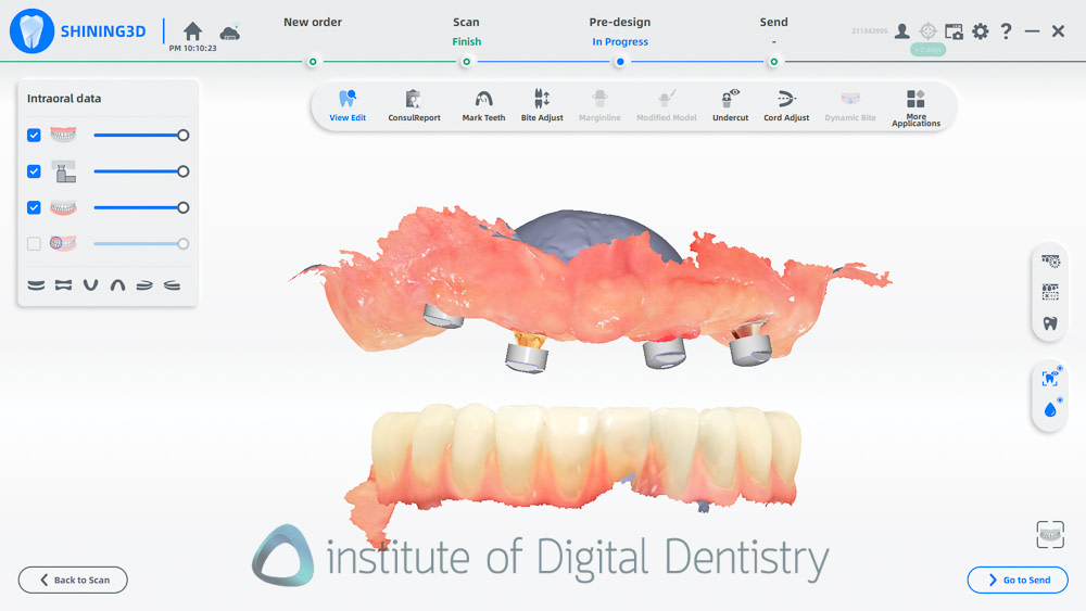 shining_3D_aoralscan_elite_review_institute_of_digital_dentistry53