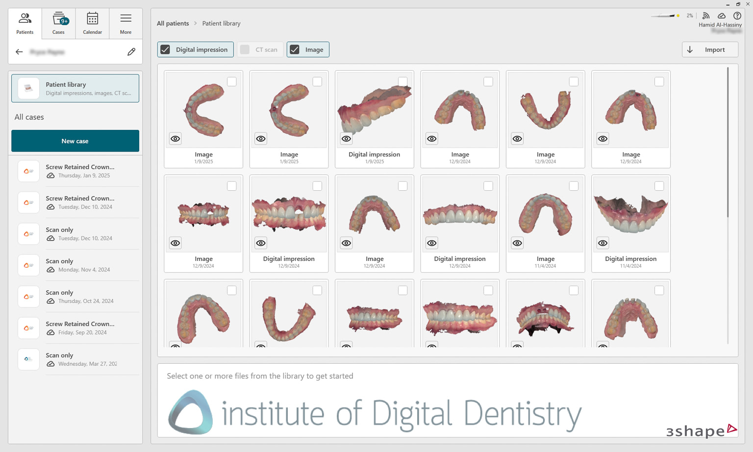 3shape_software_dental_studio_idd_review12