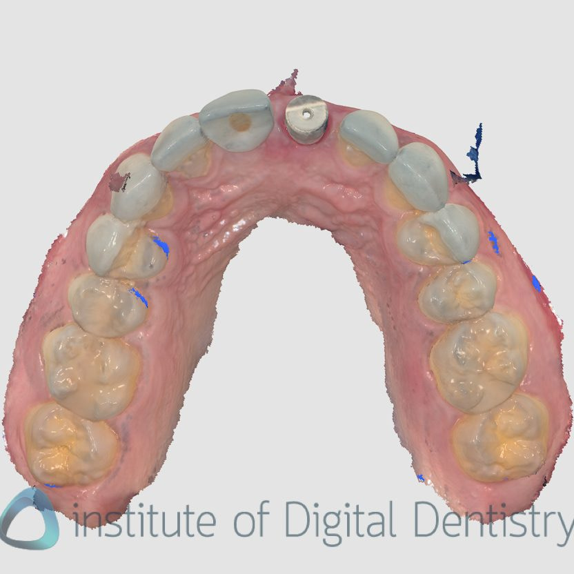3shape_software_dental_studio_idd_review16