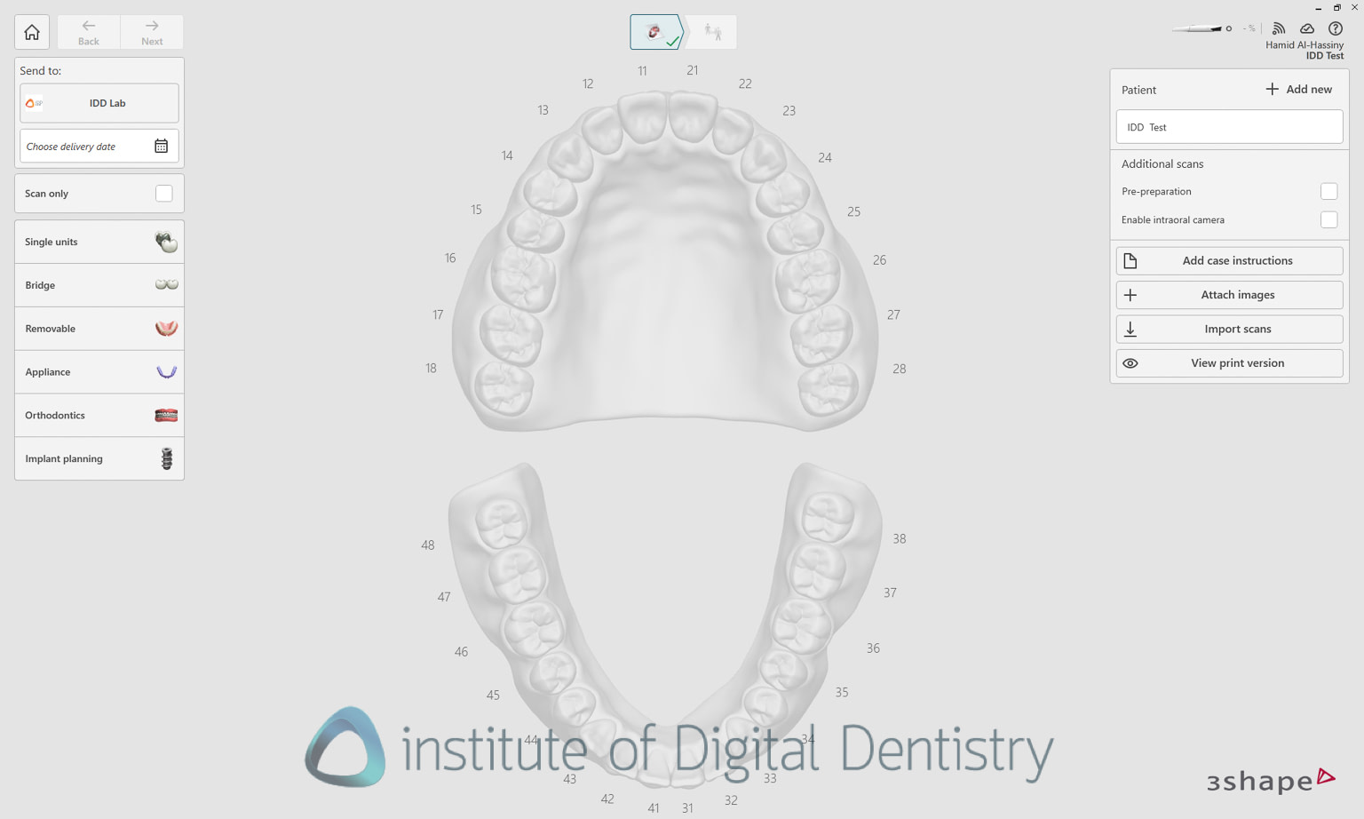 3shape_software_dental_studio_idd_review18