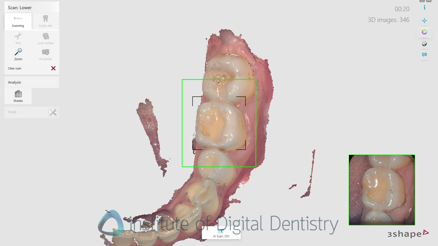 3shape_software_dental_studio_idd_review28