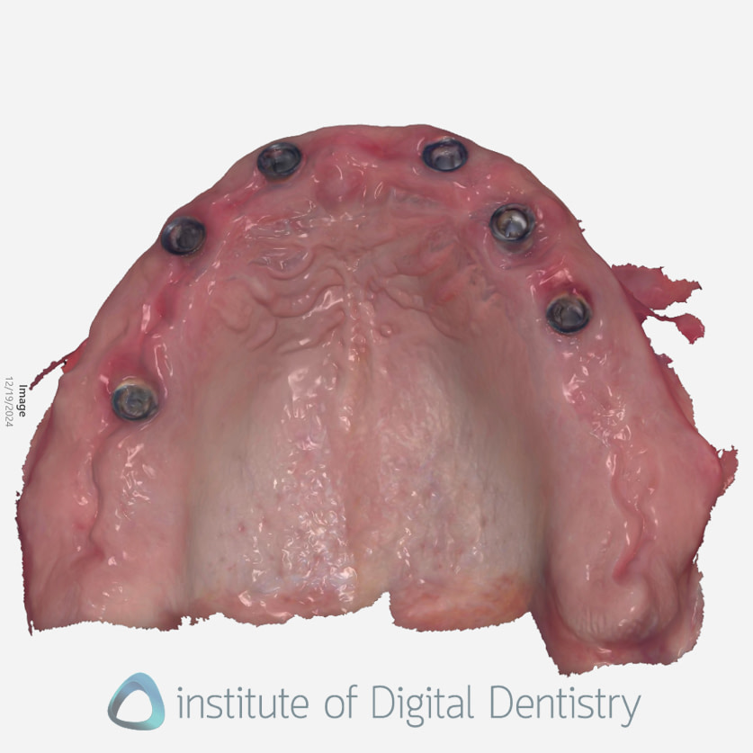 3shape_software_dental_studio_idd_review38