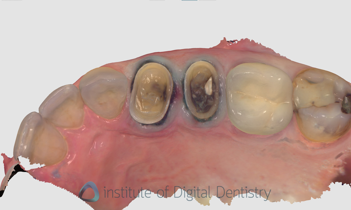 3shape_software_dental_studio_idd_review40