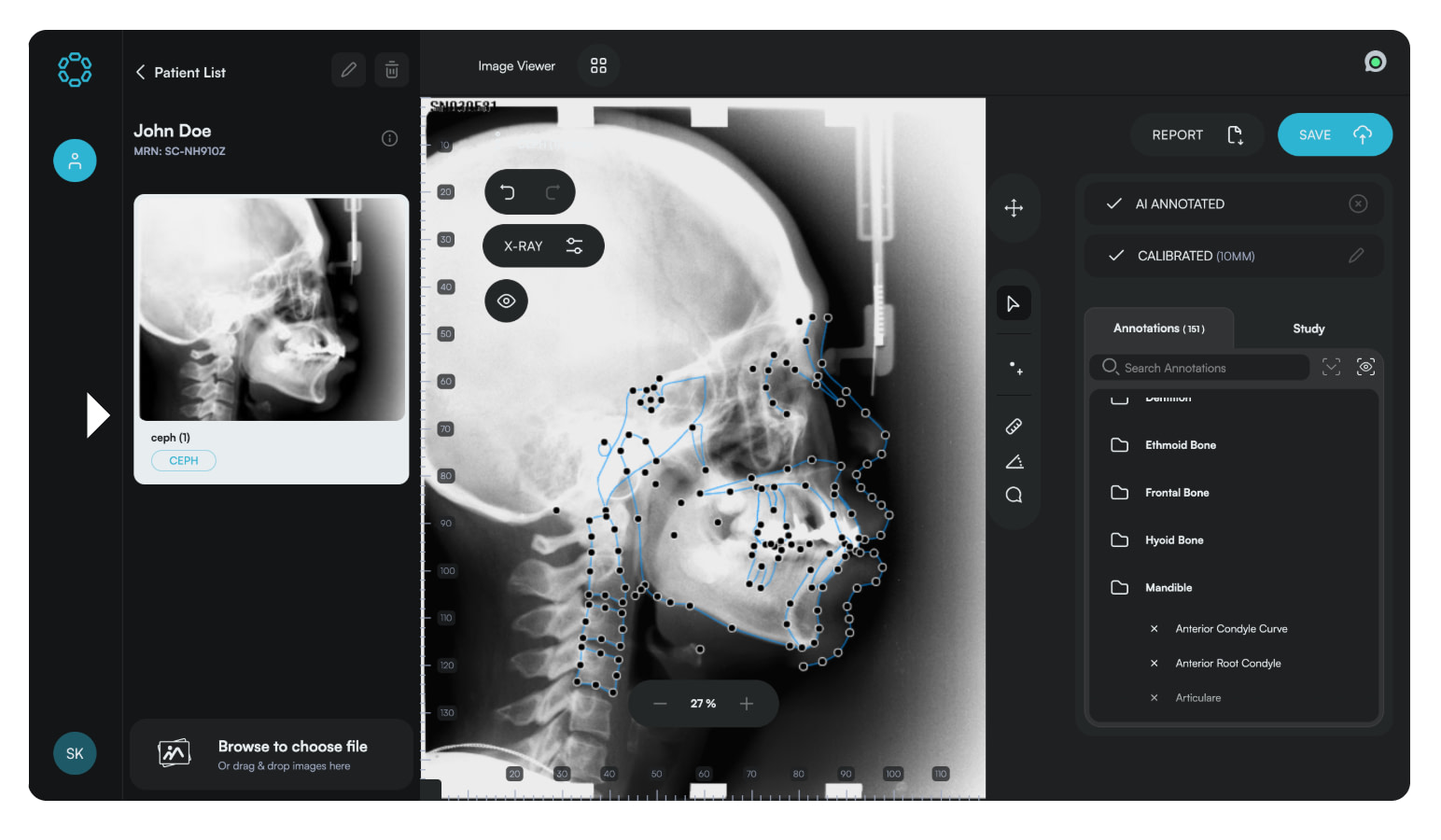 Eyes-of-ai-idd-blog-cephalometric-analysis-digital-dentistry-after
