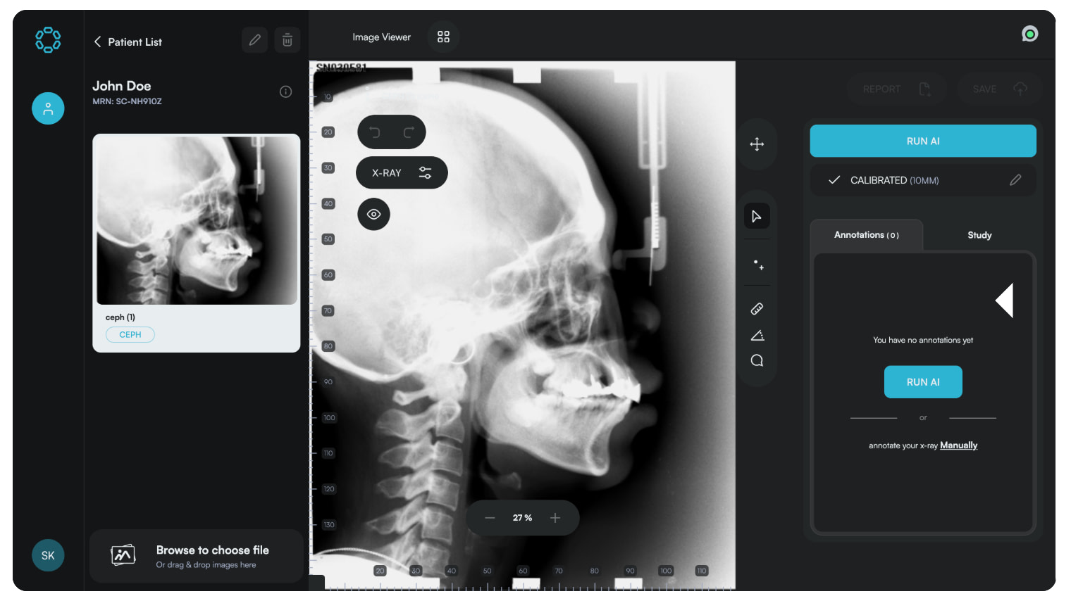 Eyes-of-ai-idd-blog-cephalometric-analysis-digital-dentistry-before