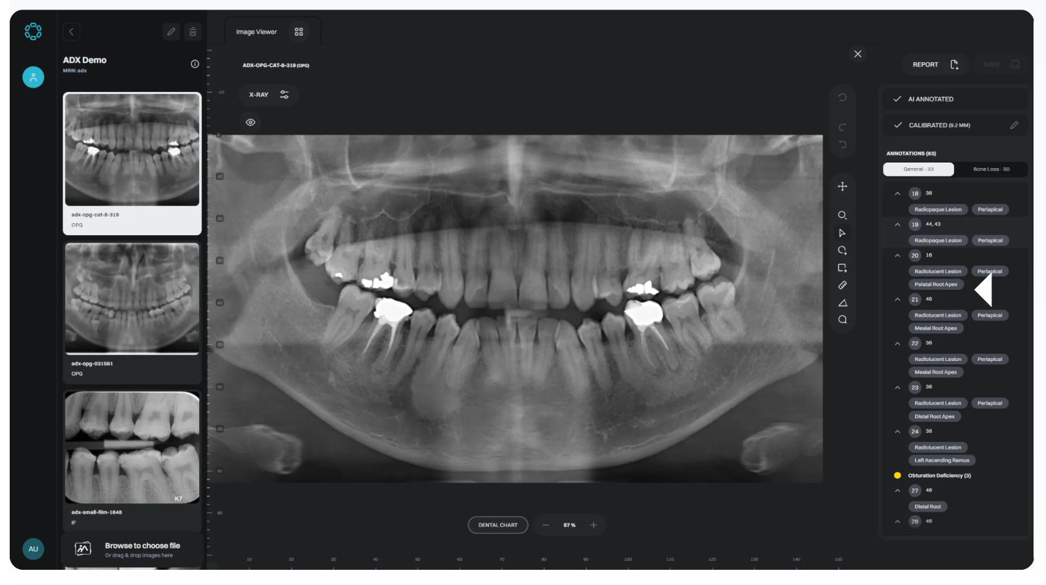 Eyes-of-ai-idd-blog-cephalometric-analysis-digital-dentistry-pathology-detection-before