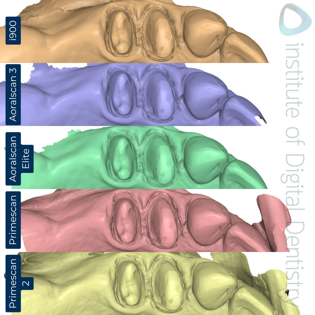 dentsply-sirona-primescan-2-cerec-primescan-shining-3d-dental-aoralscan-3-elite-medit-i900-intraoral-scanner-comparison-idd-compares-institute-of-digital-dentistry-blog-stl-scan-view