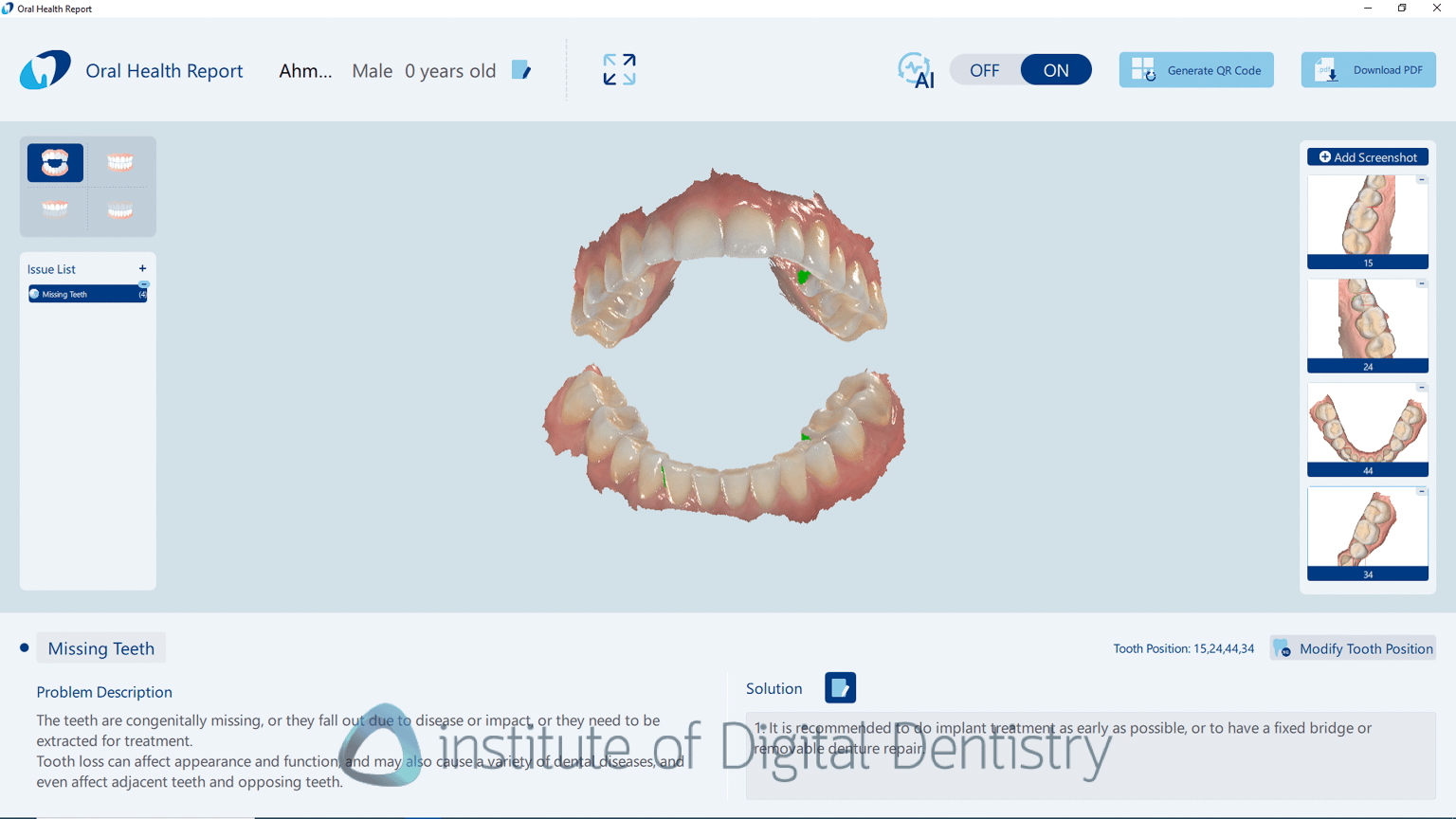 helios_500_review_intra_oral_scanner_iDD29