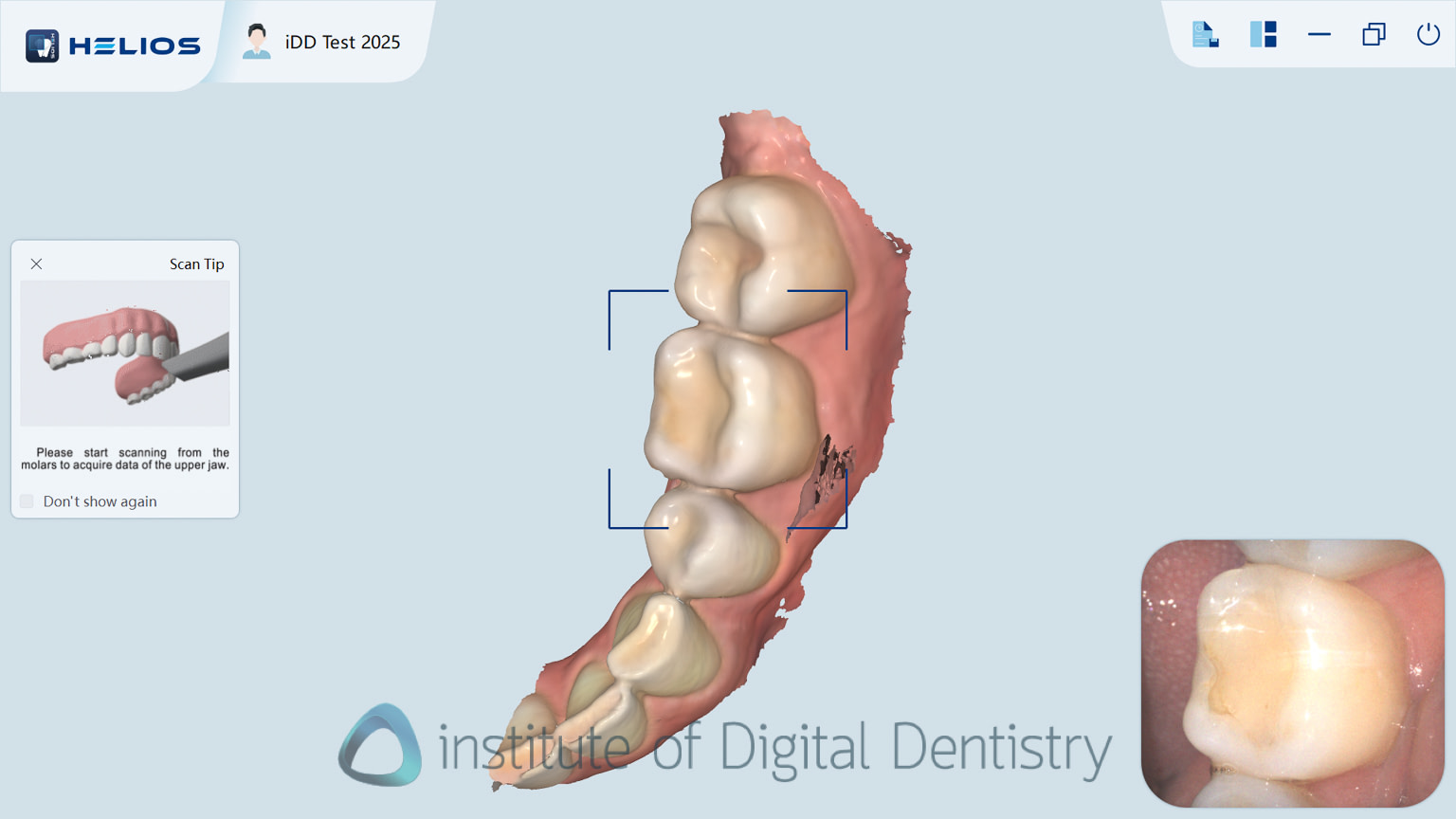 helios_500_review_intra_oral_scanner_iDD8