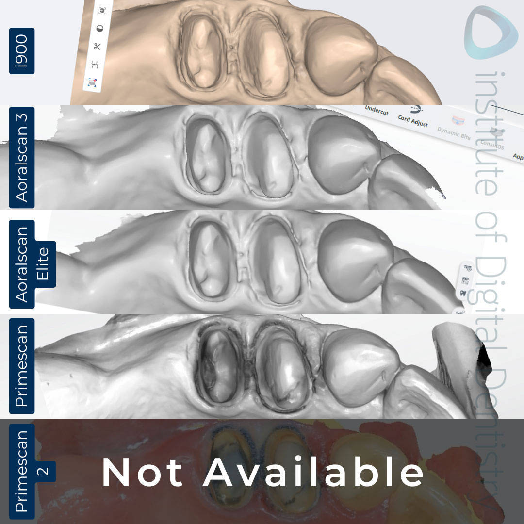 iDD_Compares_monochrome_scan