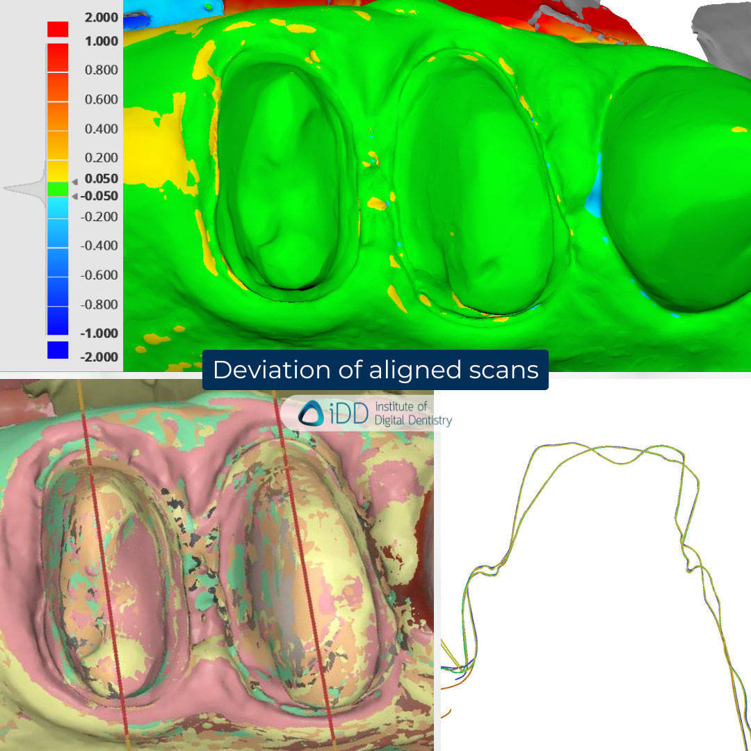 iDD_Compares_stl-scan-view-deviation-display-accuracy-alignment