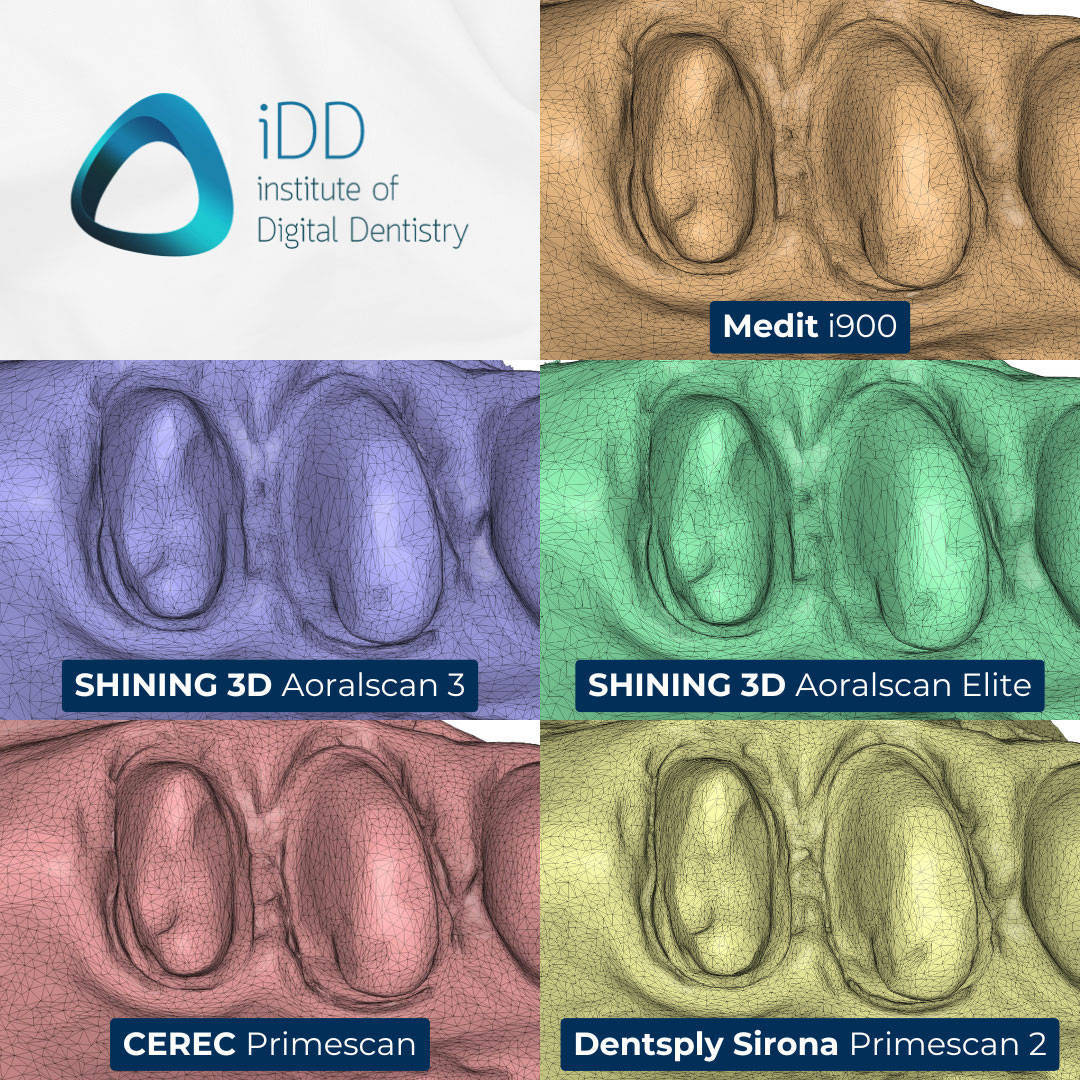 iDD_Compares_stl-scan-view-tesselation-mesh-density-triangles