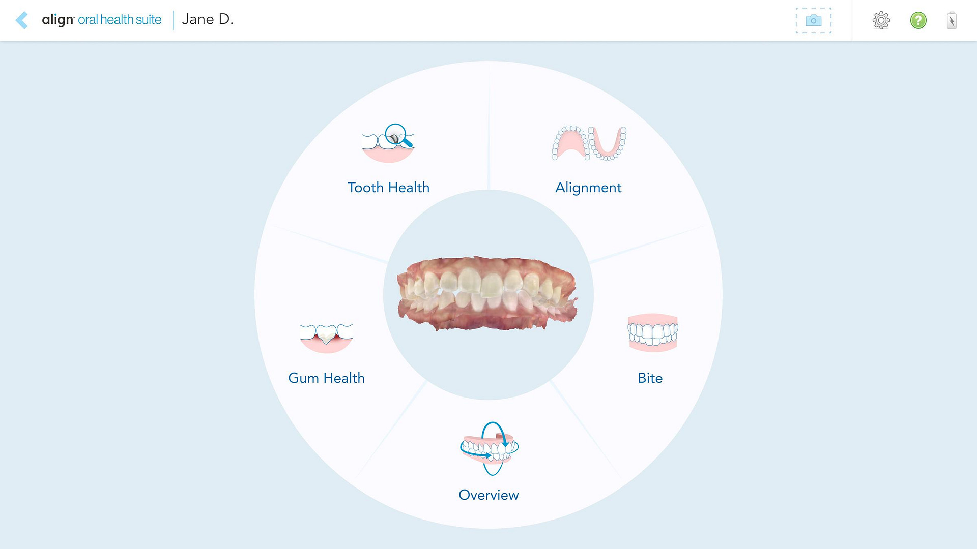 iTero-design-suite-idd-blog-digital-dentistry-align-oral-health-suite