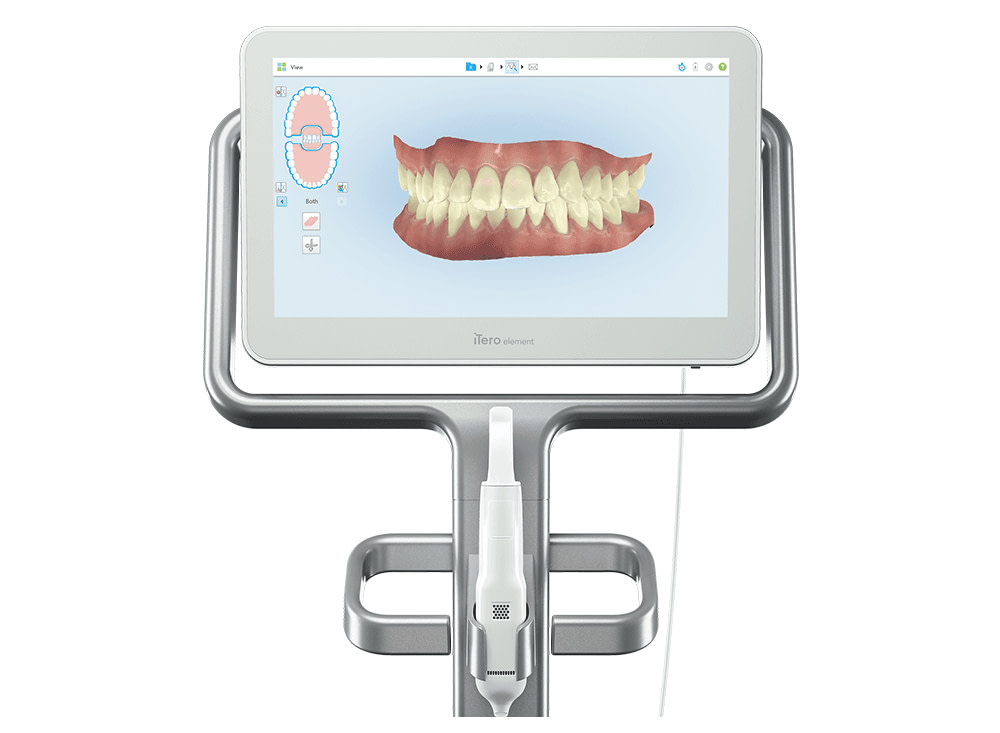 iTero-design-suite-idd-blog-digital-dentistry-element-2-ios