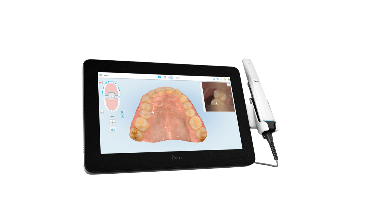 iTero-design-suite-idd-blog-digital-dentistry-lumina