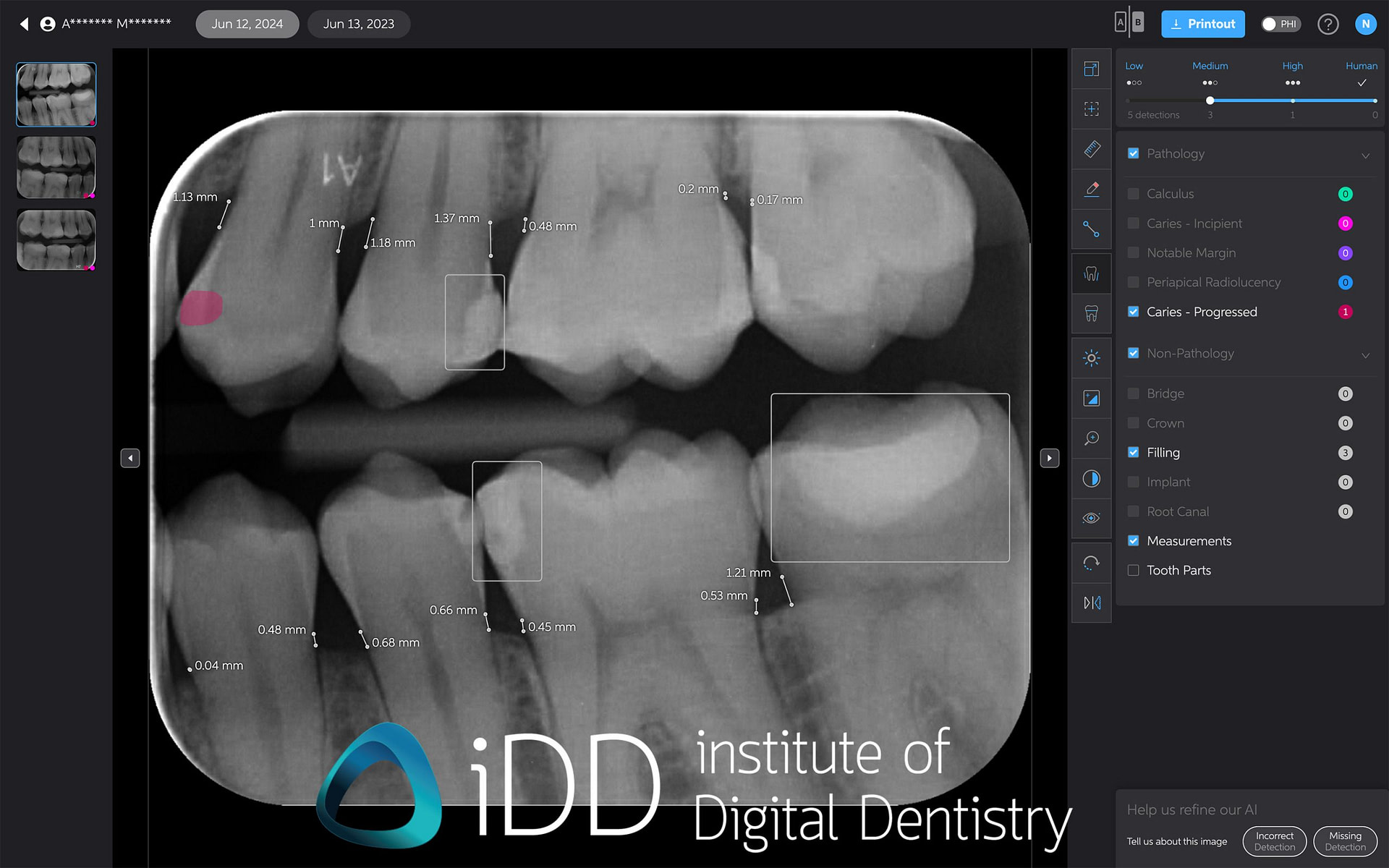pearl_velmenI_comparison