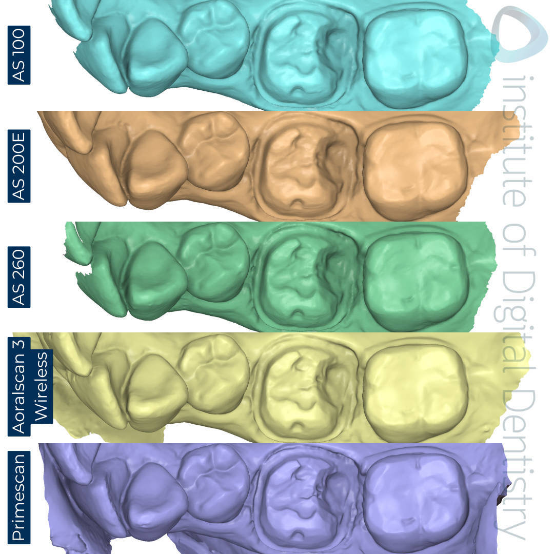 STL-scan-medit-design-Alliedstar-AS-100-AS200E-AS-260-SHINING-3D-Aoralscan-3-Wireless-Dentsply-Sirona-CEREC-Primescan-iDD-Compares-Institute-of-Digital-Dentistry-1x1-1