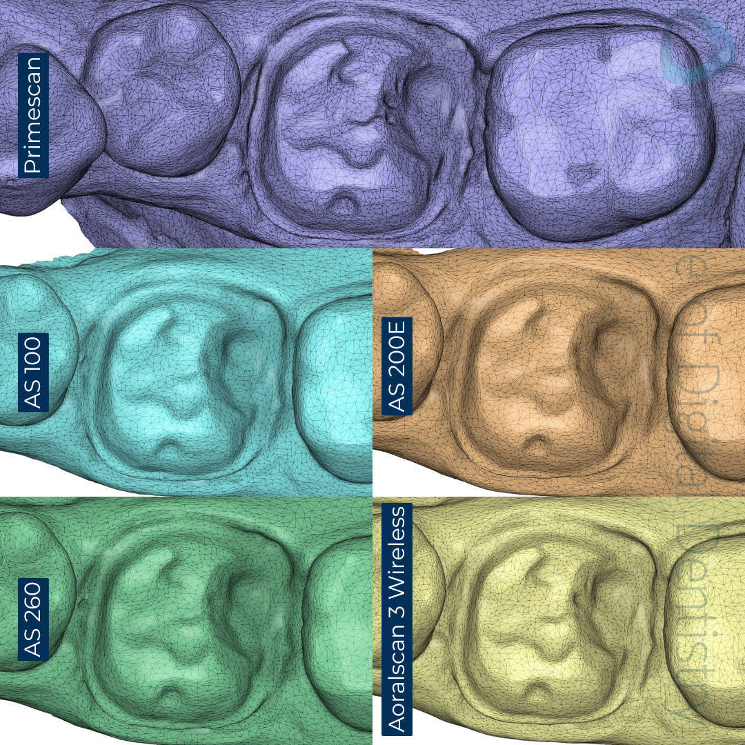 STL-scan-mesh-density-tessellation-medit-design-Alliedstar-AS-100-AS200E-AS-260-SHINING-3D-Aoralscan-3-Wireless-Dentsply-Sirona-CEREC-Primescan-iDD-Compares-Institute-of-Digital-Dentistry-1x1-1