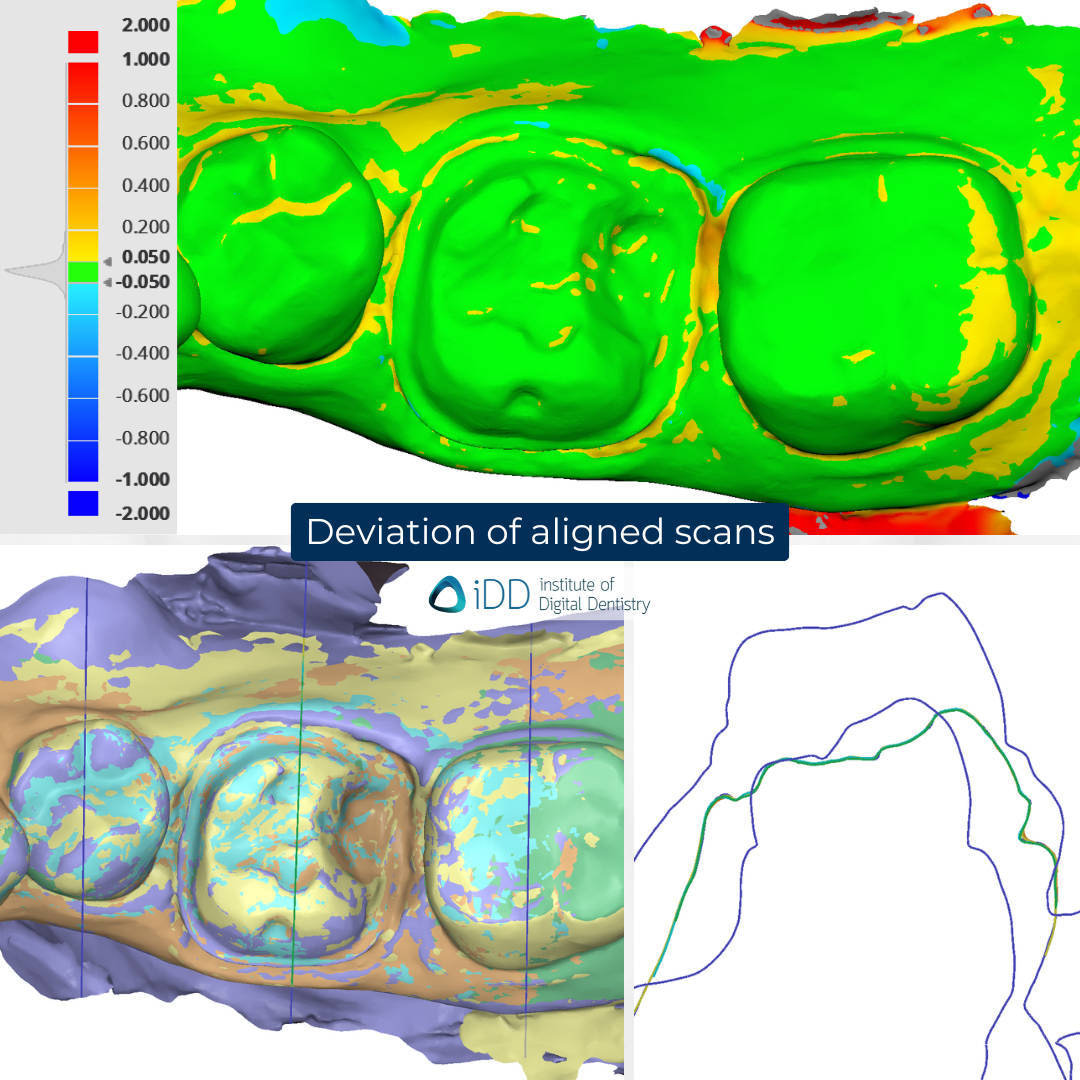 Deviation-analysis-Alliedstar-AS-100-AS200E-AS-260-SHINING-3D-Aoralscan-3-Wireless-Dentsply-Sirona-CEREC-Primescan-iDD-Compares-Institute-of-Digital-Dentistry-1x1-1