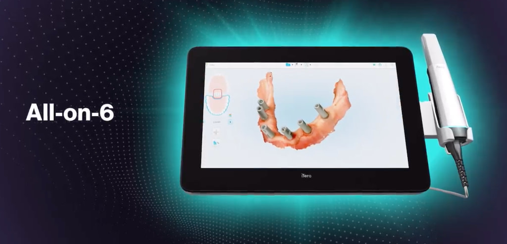 itero lumina restorative pro2