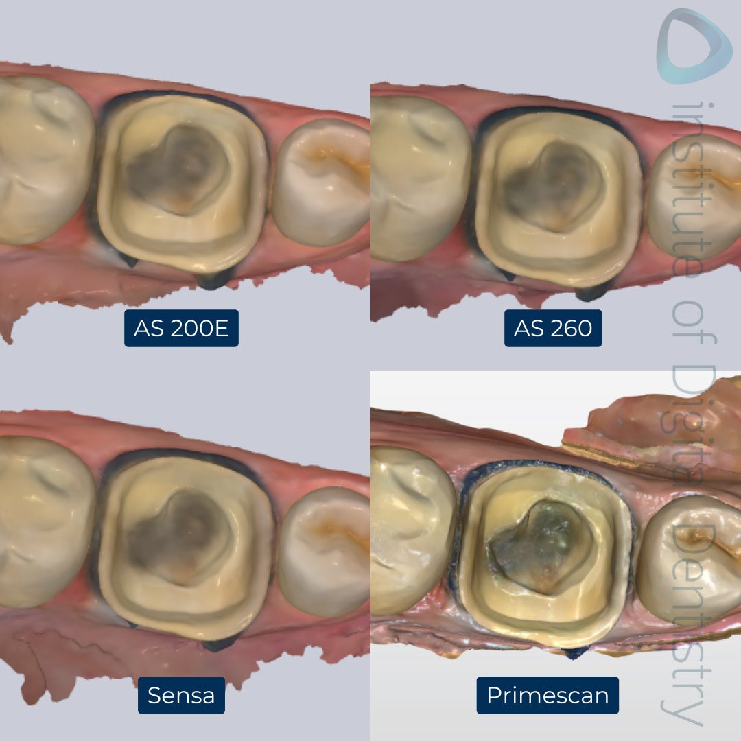 2-Alliedstar-AS260-AS200E-Sensa-Dentsply-Sirona-Primescan-intraoral-scanner-ios-idd-compares-lower-native-color