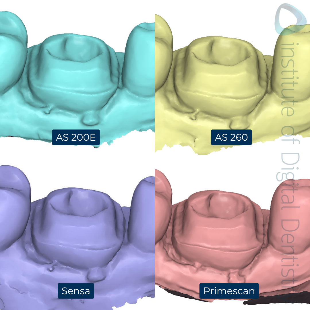 5-Alliedstar-AS260-AS200E-Sensa-Dentsply-Sirona-Primescan-intraoral-scanner-ios-idd-compares-lower-margin-prep-buccal