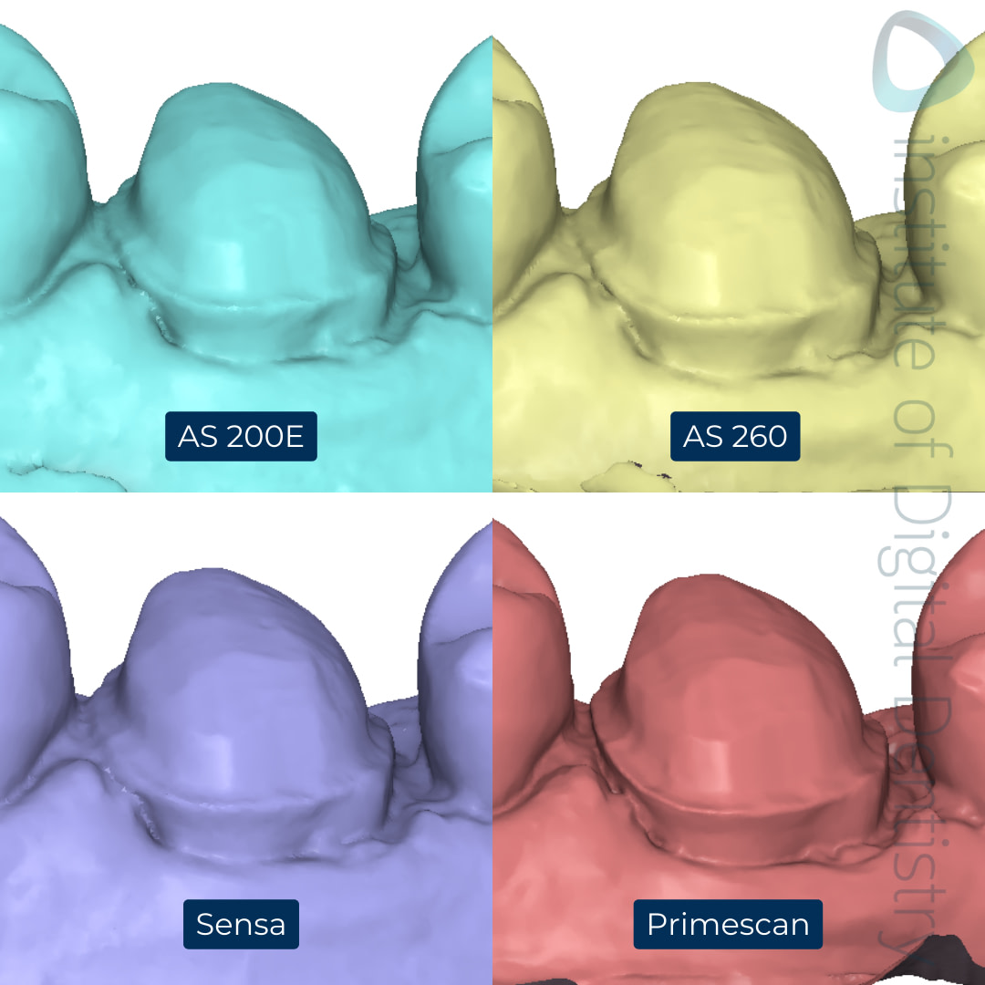6-Alliedstar-AS260-AS200E-Sensa-Dentsply-Sirona-Primescan-intraoral-scanner-ios-idd-compares-upper-margin-prep-buccal