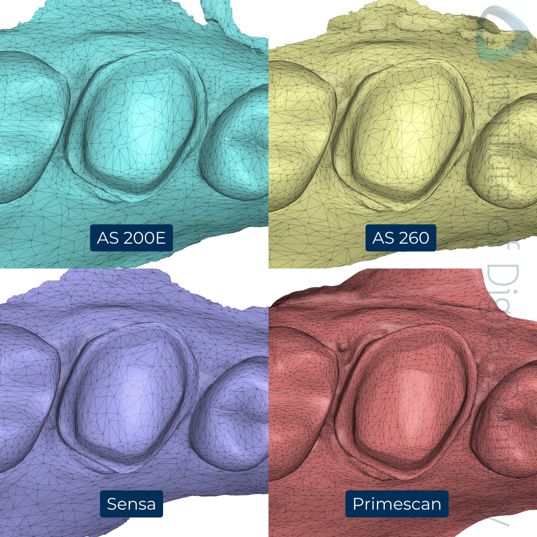 8-Alliedstar-AS260-AS200E-Sensa-Dentsply-Sirona-Primescan-intraoral-scanner-ios-idd-compares-upper-density-mesh-tessellation