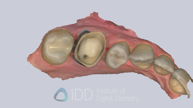 AS260_Review_Institute_of_Digital_Dentistry24