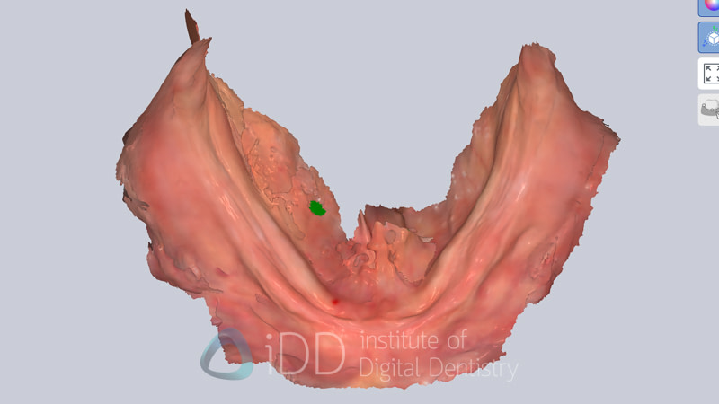AS260_Review_Institute_of_Digital_Dentistry27