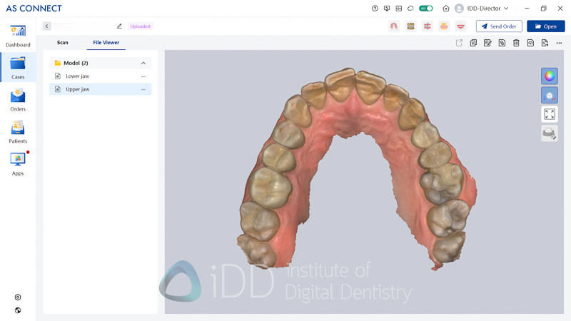 IOS_AS260_Review_Institute_of_Digital_Dentistry4