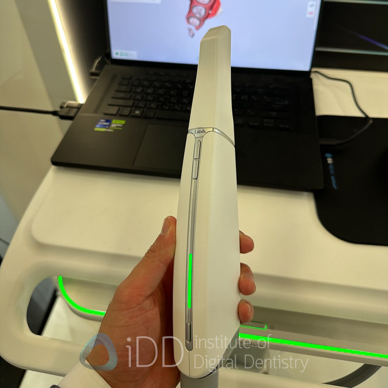 LILIVIS_OCT_SCANNER_IDS_20251