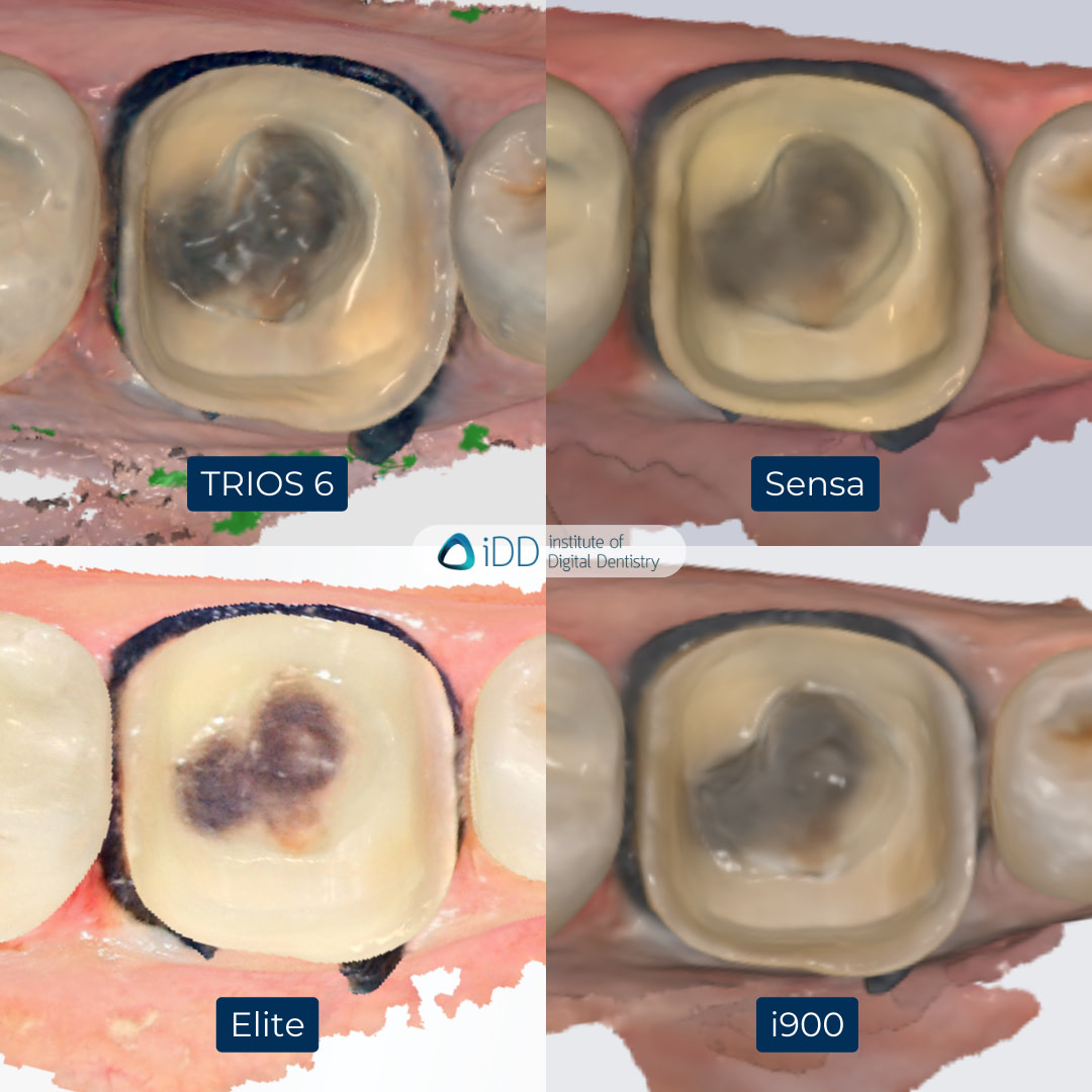 2-3Shape-TRIOS-6-Alliedstar-Sensa-Shining-3D-Aoralscan-Elite-Medit-i900-intraoral-scanner-ios-idd-compares-lower-native-scan-color