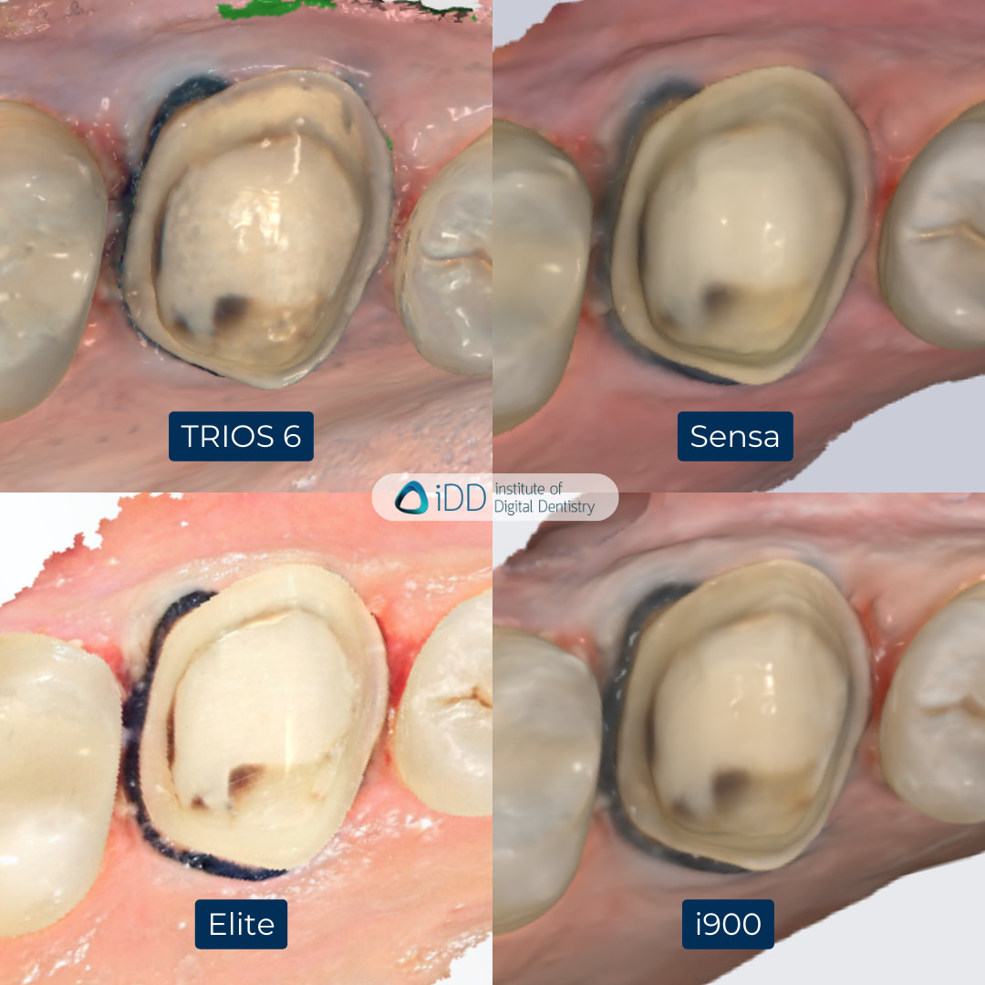 2-3Shape-TRIOS-6-Alliedstar-Sensa-Shining-3D-Aoralscan-Elite-Medit-i900-intraoral-scanner-ios-idd-compares-upper-native-scan-color