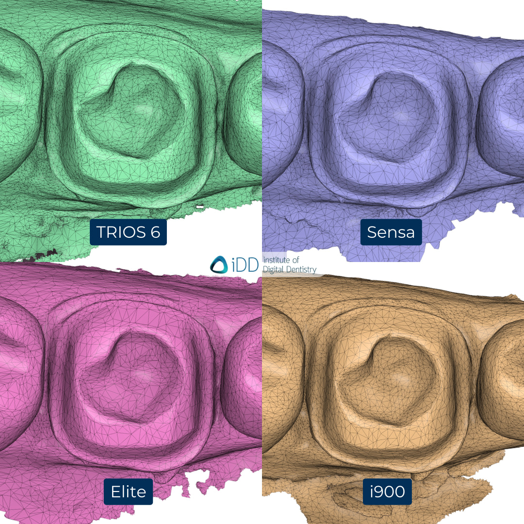 7-3Shape-TRIOS-6-Alliedstar-Sensa-Shining-3D-Aoralscan-Elite-Medit-i900-intraoral-scanner-ios-idd-compares-lower-stl-scan-mesh-density-tessellation