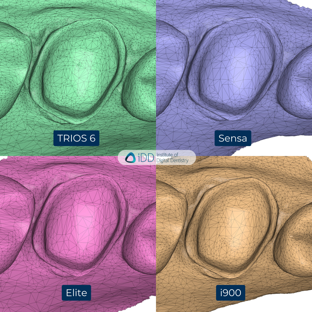 7-3Shape-TRIOS-6-Alliedstar-Sensa-Shining-3D-Aoralscan-Elite-Medit-i900-intraoral-scanner-ios-idd-compares-upper-stl-scan-mesh-density-tessellation