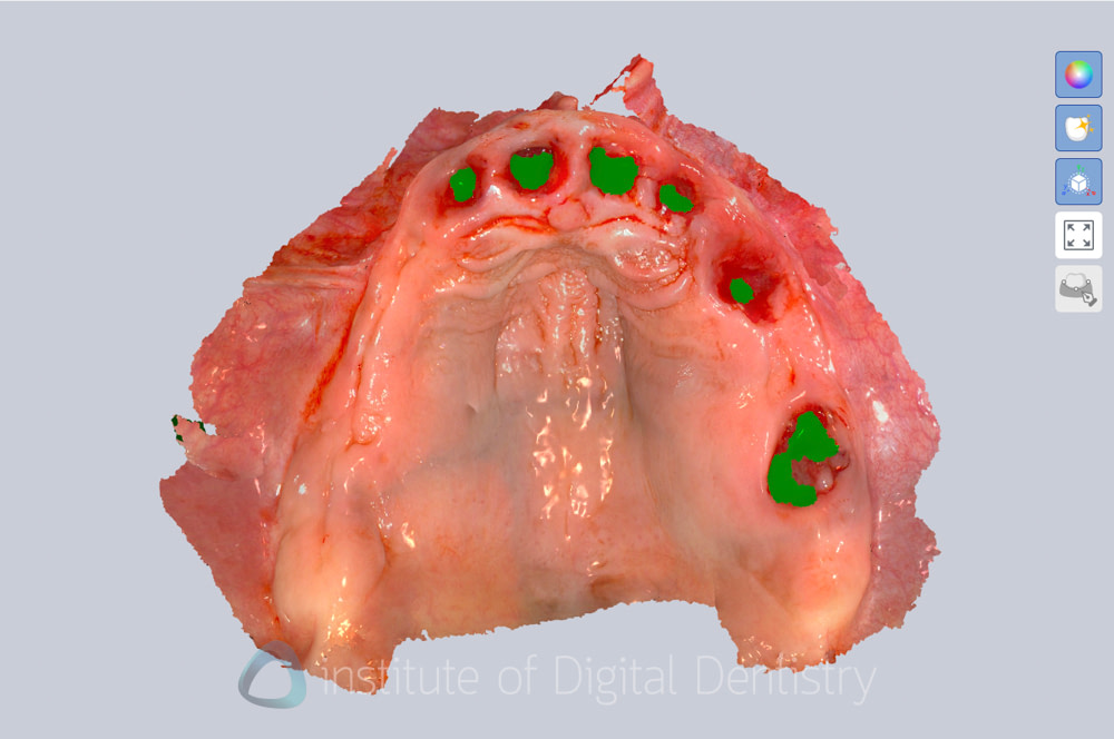 alliedstar_sensa_intraoral_scanner_review_iDD (12)