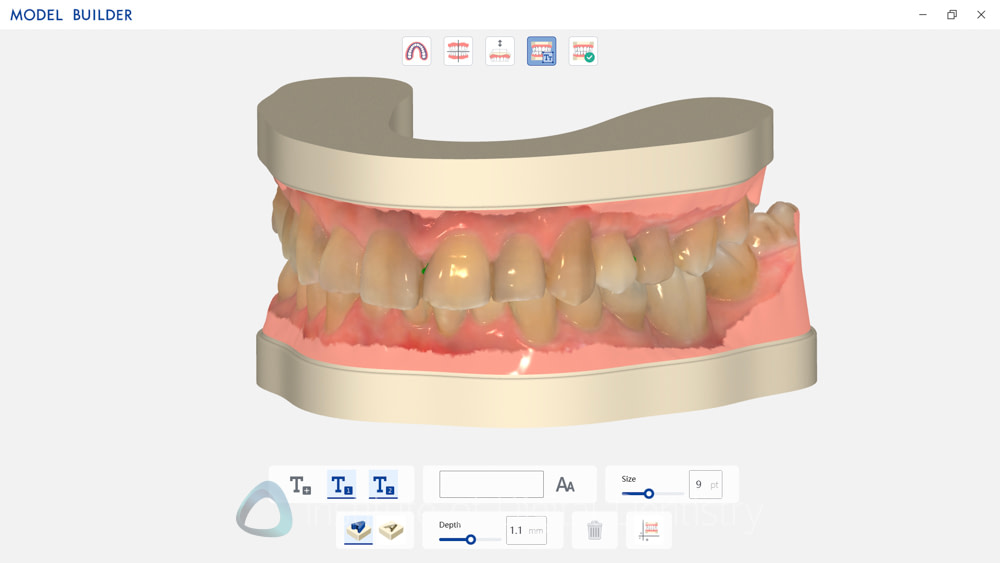 alliedstar_sensa_intraoral_scanner_review_iDD (14)
