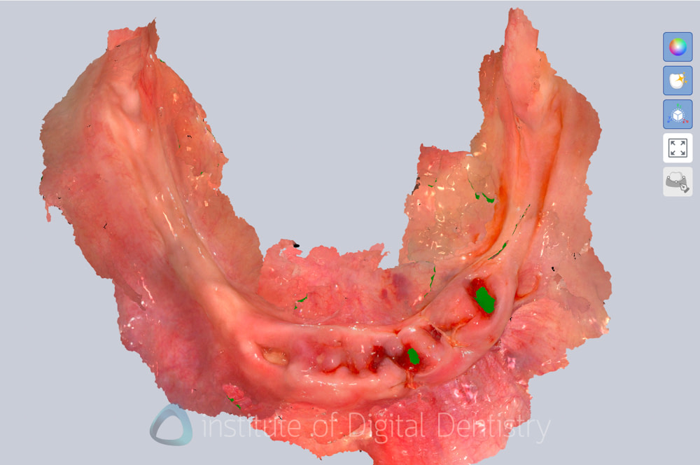 alliedstar_sensa_intraoral_scanner_review_iDD (18)