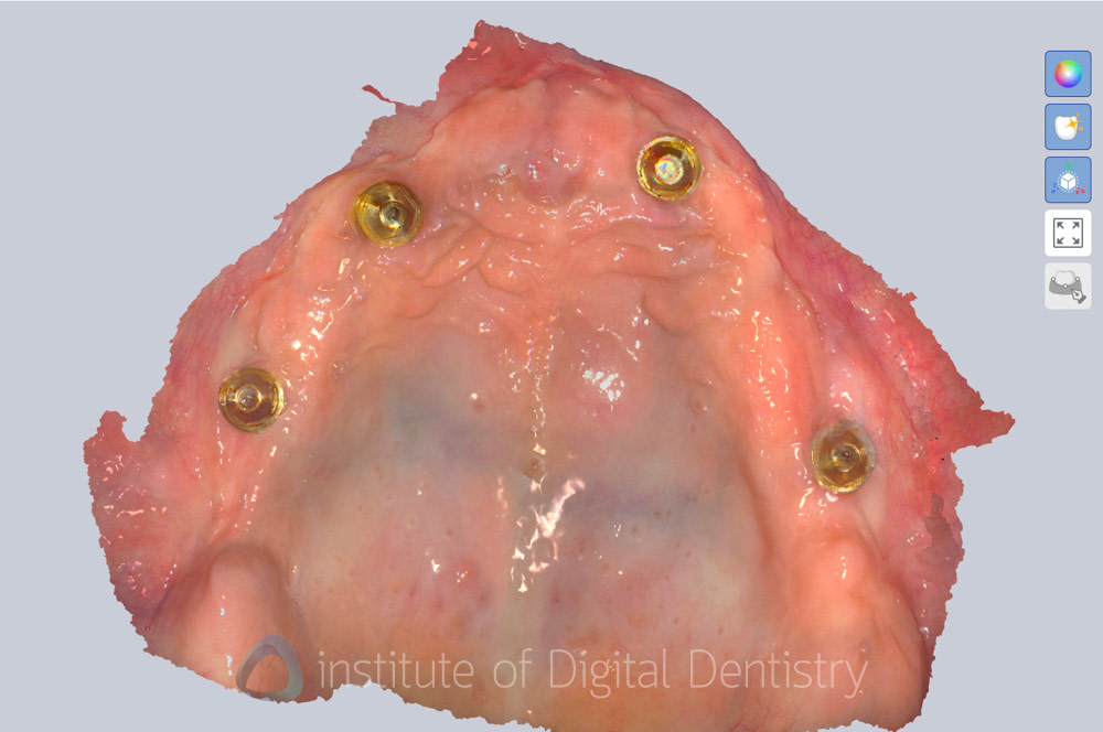 alliedstar_sensa_intraoral_scanner_review_iDD (2)