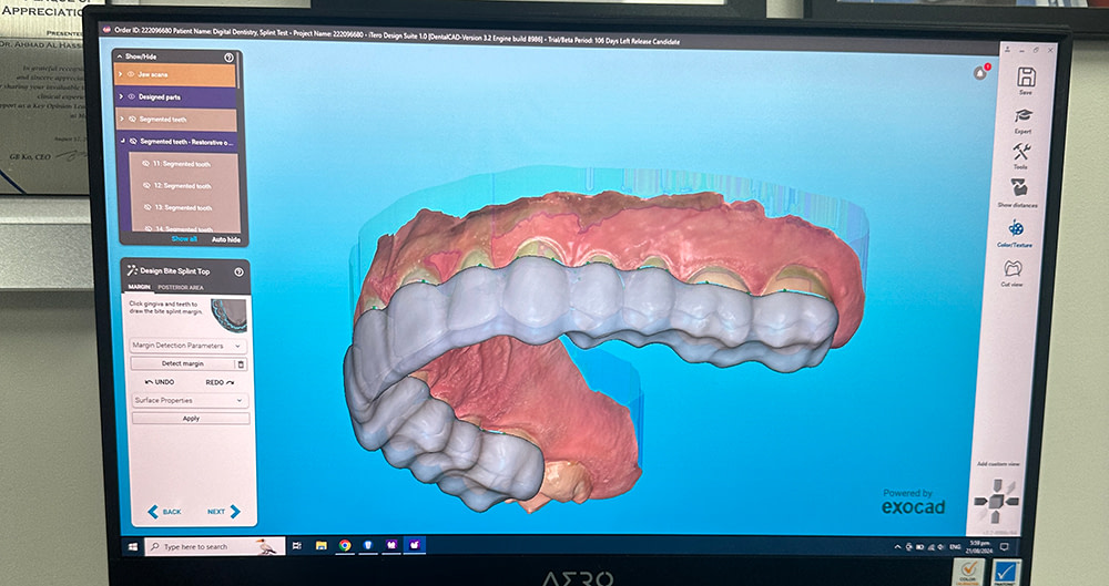 itero_lumina_design_suite_splints