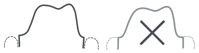 top five mistakes when scanning institute of digital dentistry (2)