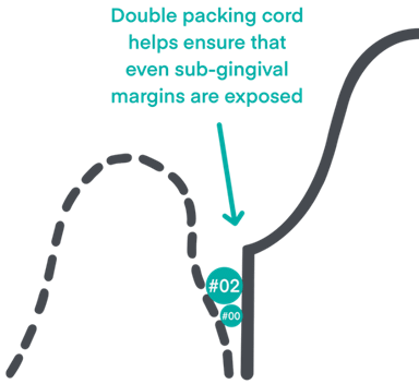 top five mistakes when scanning institute of digital dentistry (3)