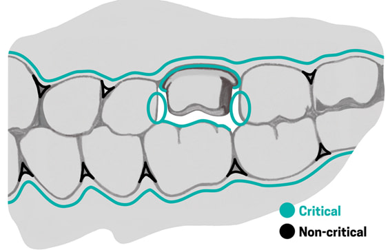 top five mistakes when scanning institute of digital dentistry iDD (1)